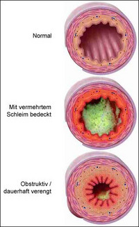 querschnitt-durch-bronchien